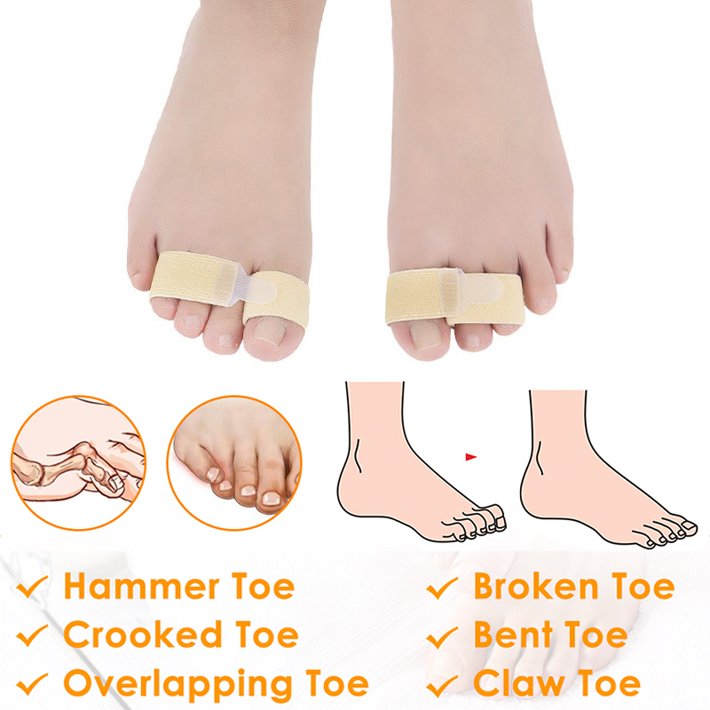 Pexmen 1/2/5/10Pcs Hammer Toe Straightener Toe Splints Cushions Bandages for Correcting Crooked & Overlapping Toes Protector: Silver