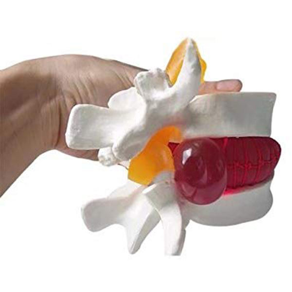 1pc Anatomical Lumbar Disc Herniation Lumbar Spine Model White Color J99Store