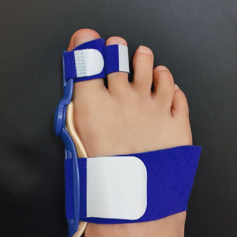 2 stuks Grote Teen Bunion Apparaat Spalk Stijltang 2 gat Hallux Valgus Bretels Teen Correctie Voet Pijnbestrijding Duim Zorg orthopedische: Blauw