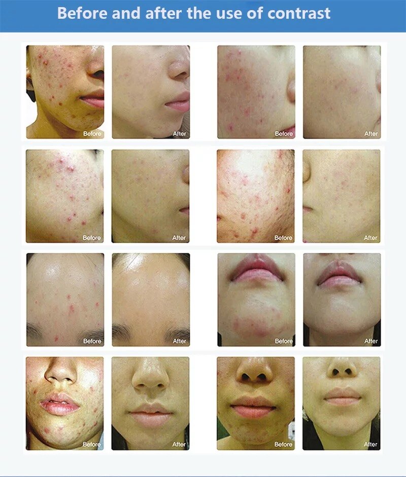 7 Color PDT Machine LED Light Therapy Body Care Face Skin Rejuvenation Facial Beauty For SPA