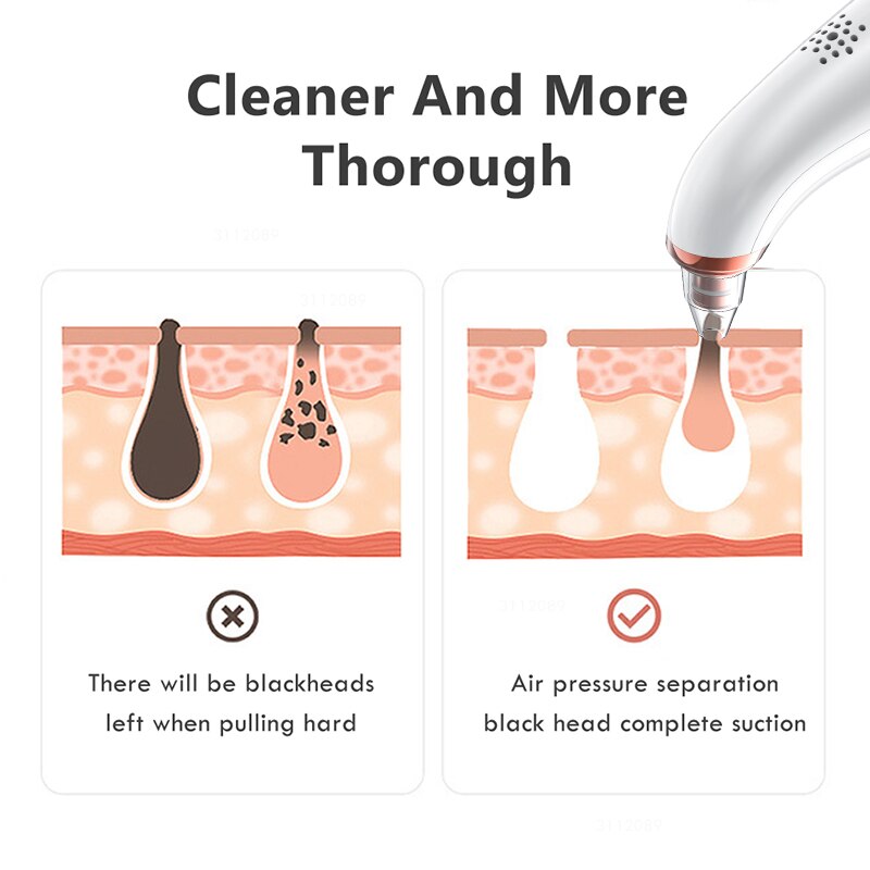 Blackhead Remover Face Deep Nose Cleaner T Zone Pore Acne Pimple Removal Vacuum Suction Facial Diamond Beauty Clean Skin Tool Bl