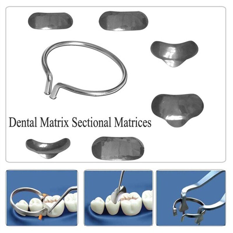 Kit completo de matrices de metal contorneadas, matriz dental de 100 piezas, láminas de moldeo de ortodoncia, odontología