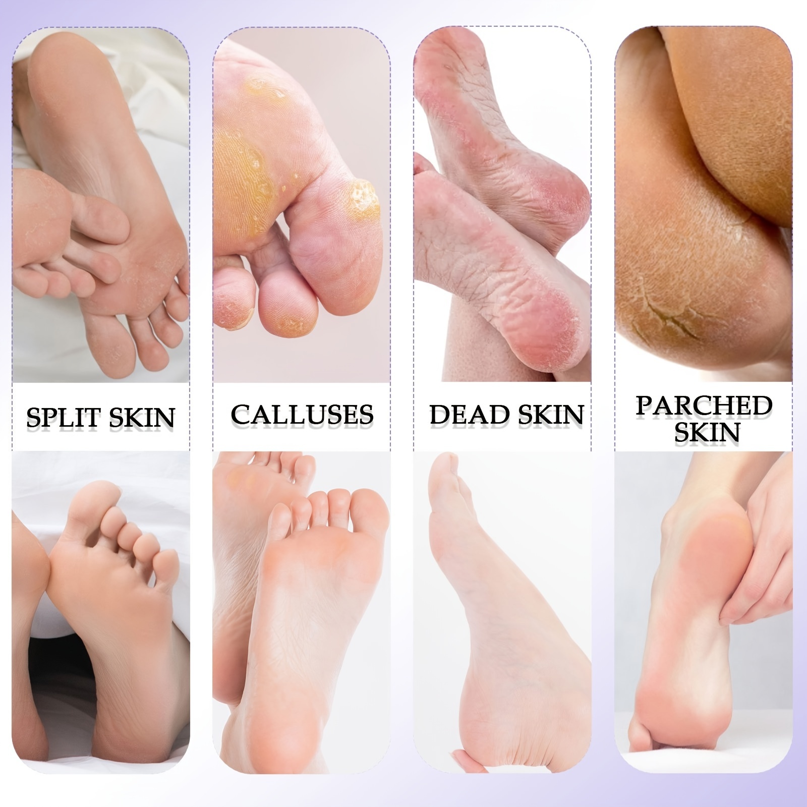 Professionele 8-in-1 pedicureset: ontvang zachte, gladde voeten met roestvrijstalen voetverzorgingshulpmiddelen!