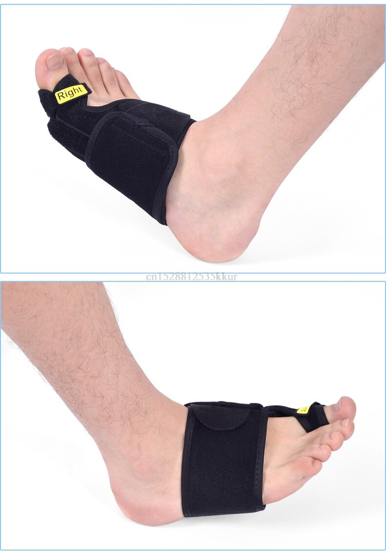Hallux valgus pro tåkorreksjon tommeltape fysisk smertelindring stort beintåkorrektor magnetisk belte 1 stk.