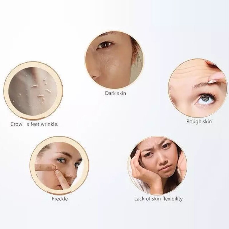 Handheld Portable Blackhead Vacuum Suction Remover electric Face vacuum Extractor Especially Desktop set