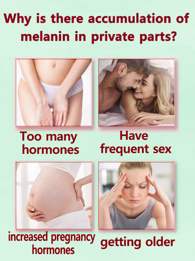 zie vaarwel tegen melanine