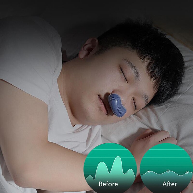 Elektrische Anti Snurken Preventie Elektronische Apparaat Slaap Stop Snore Stopper Aid