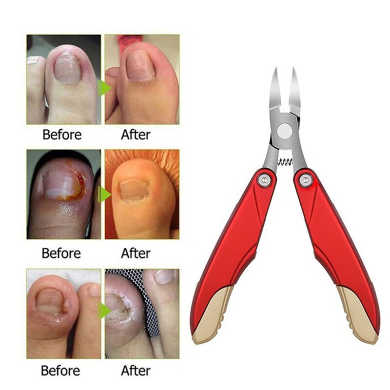 3 in 1 Nail Clippers/Nippers for Thick and Ingrown Toenails Premium Grade Stainless Steel