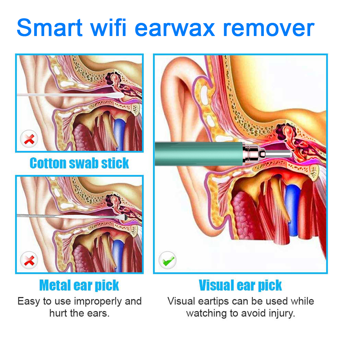 Wifi Earwax Remover Smart Visual Earpick Pen Wireless APP For IOS/Android Oral/ear Multifunction Examination Endoscope Camera