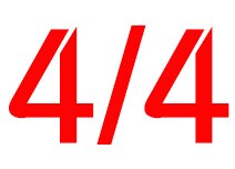 Professionele Viool Accessoires Ombro Pad Viool Legering Schouder Restauratie Verstelbare 4/4 3/4 Violino Onderdelen & Accessoires: Light Grey