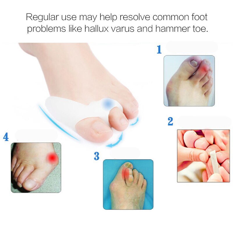 Täglich Silikon Gel Fuß Zehe Separator &Ampere; Daumen Hallux Valgus Schutz &Ampere; Ballen Erzähler Bicyclischen Daumen Orthopädische Richtige