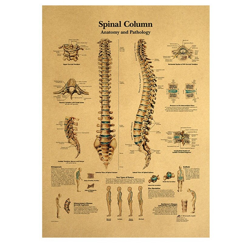 Retro Human Body Structure Diagram Back Spine Nerve Structure Diagram Poster Home Decor Kraft Paper Wall Sticker 42x30cm: Default Title