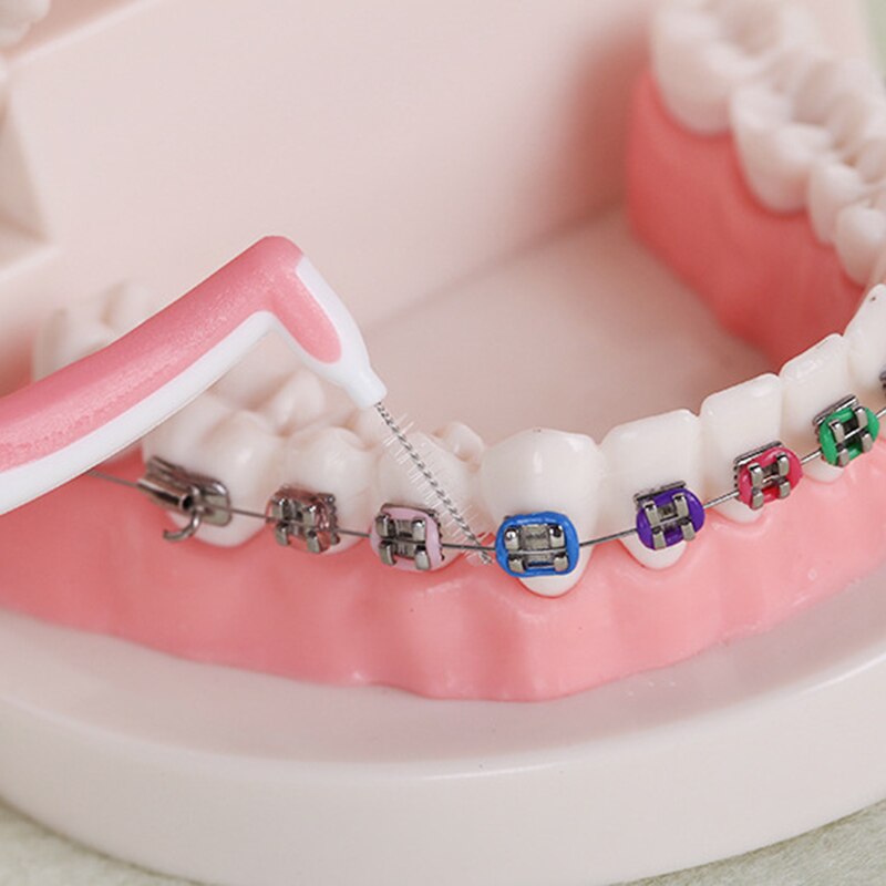 1 PC. 0,7/0,8/1,0/1,2mm Interdentalbürsten Formen der zahnseide Kieferorthopädische zahnbürste Mundpflege Zahnbürste reinigung