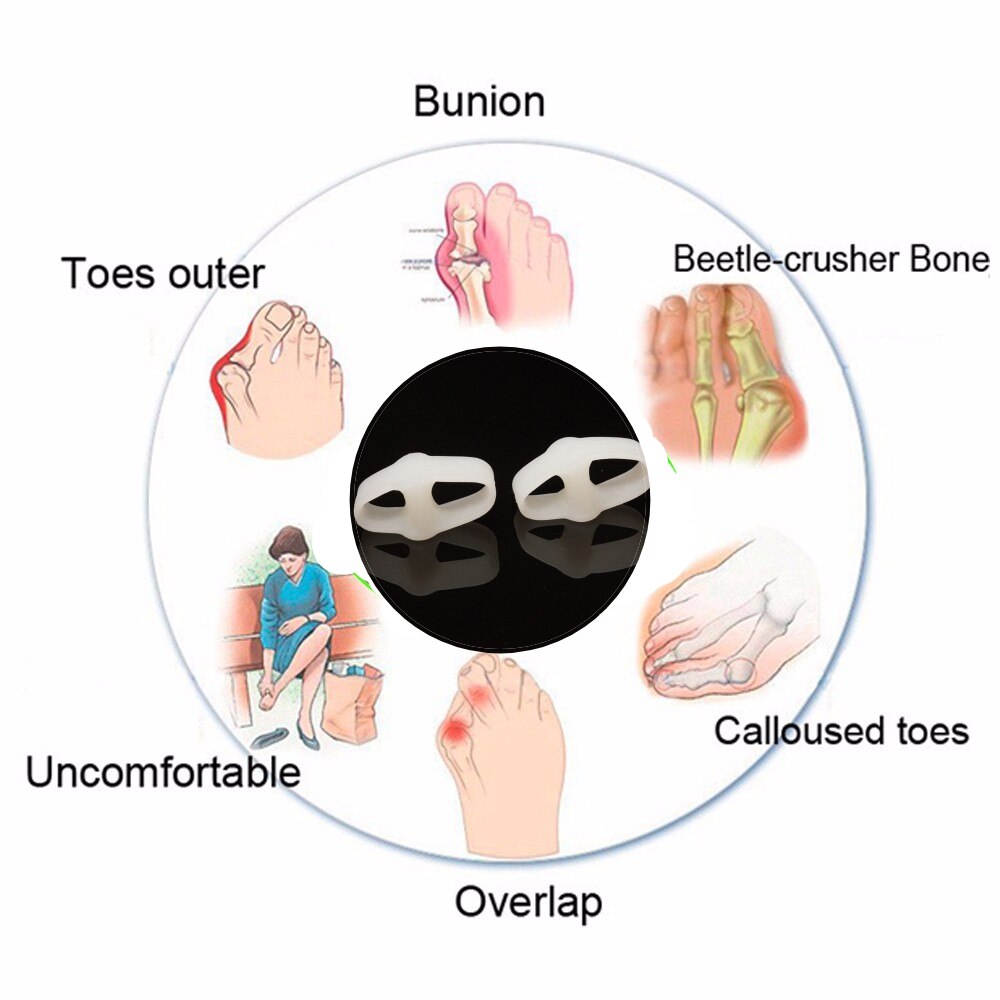 55Pairs Foot Separators Adjustable Toe Stretchers Straighteners Alignment Bunion Gel Orthotics Hammer Care Tools For Pedicure