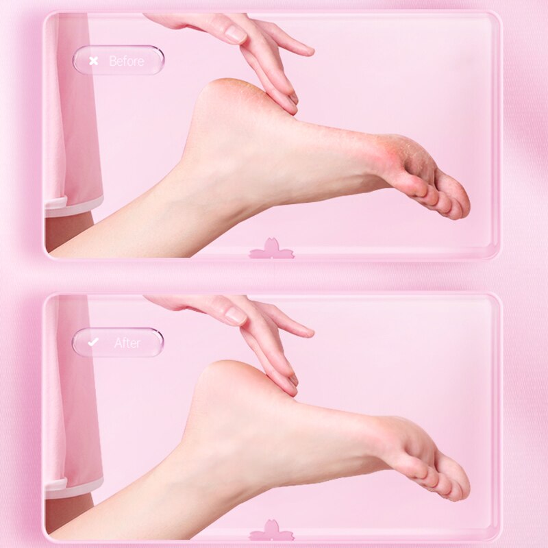 Xiaomi Showsee Pedicure elettrico per talloni rettifica strumenti per Pedicure rimozione del callo della pelle dura morta strumento professionale per la cura dei piedi