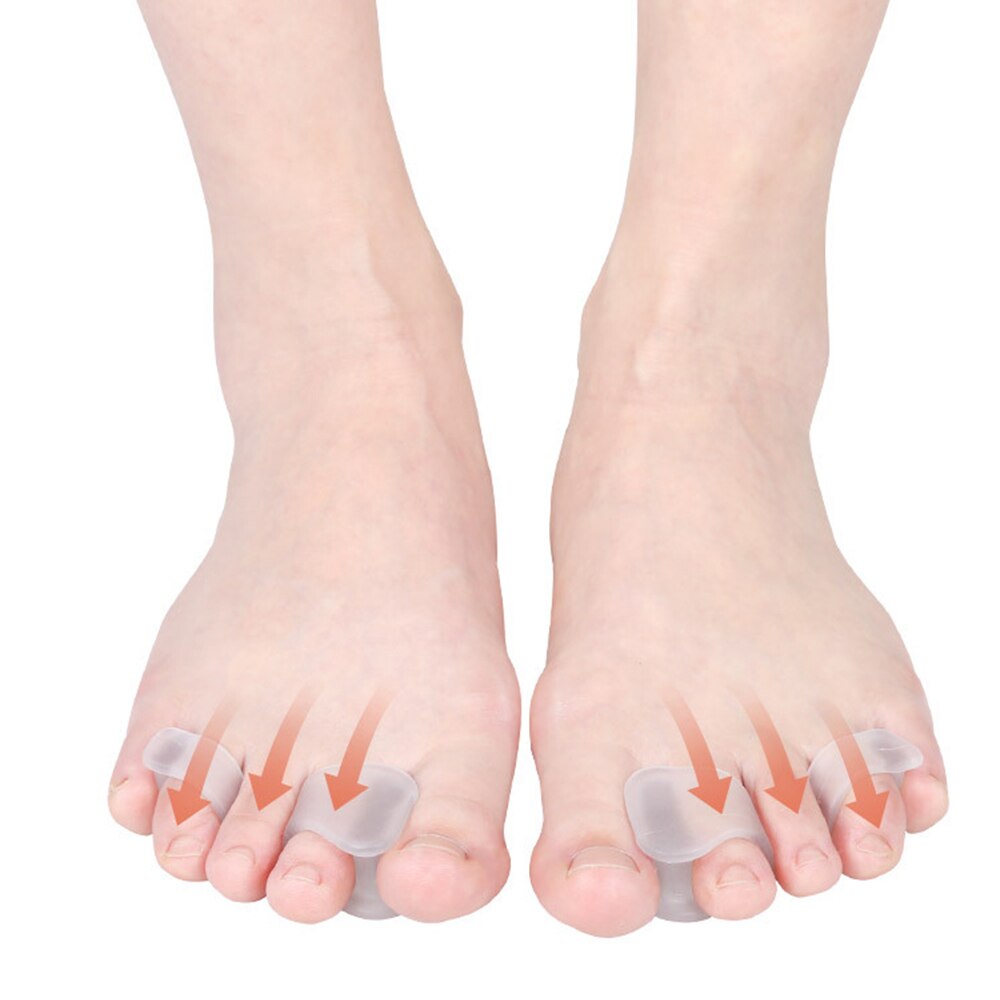 1 par tommelfinger valgus ortose stor fod knogle valgus tå separator overlappende tå split tå enhed tå glattejern