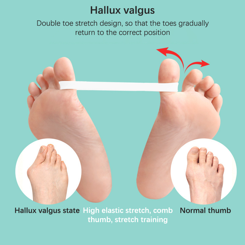 Silikon Zugband Hallux Valgus des Fuß korrektur trainings Trainings gürtel Zehen Separator Daumen Gummiband Fußpflege werkzeuge