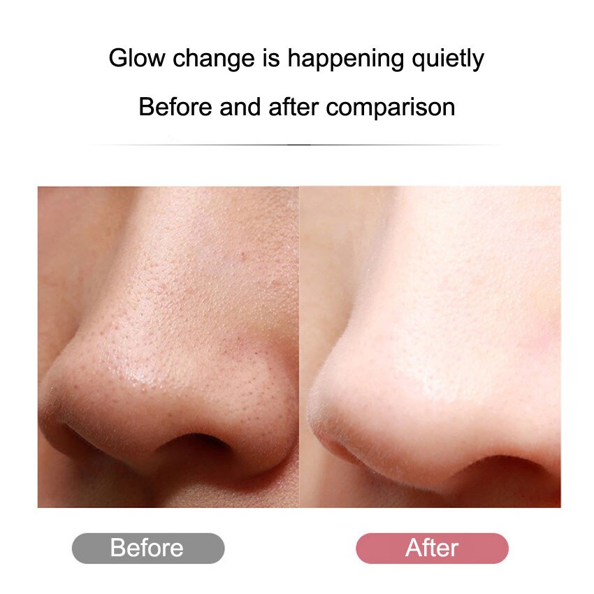 Máquina ultrasónica de la piel de la pala limpiador de la piel Facial limpiador de poros puntos negros quitar herramienta de limpieza iontoforesis instrumento