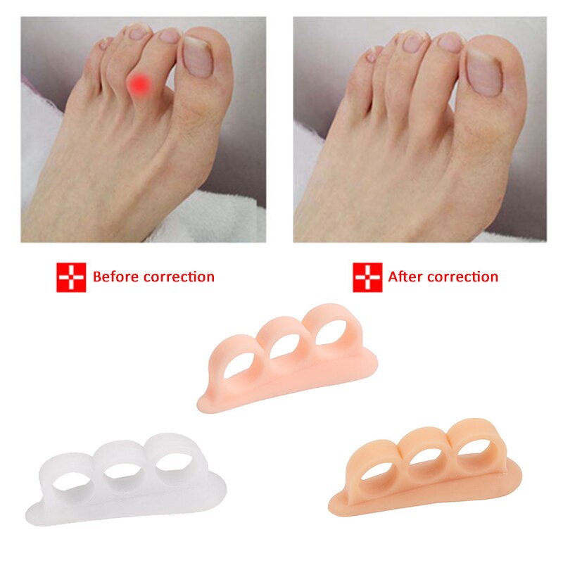 2Pcs=1Pair Toe Separators Spacer Straightening Silicone Gel Hammer Corrector for Curled Toes Hallux Valgus Feet Foot Care Tools