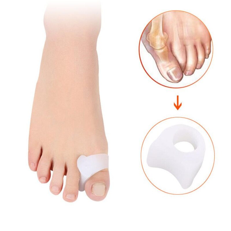 Bunion Spalk Grote Teen Straightener Corrector Foot Pain Relief Hallux Valgus Correctie Orthopedische Levert Pedicure Voetverzorging: 2PCS