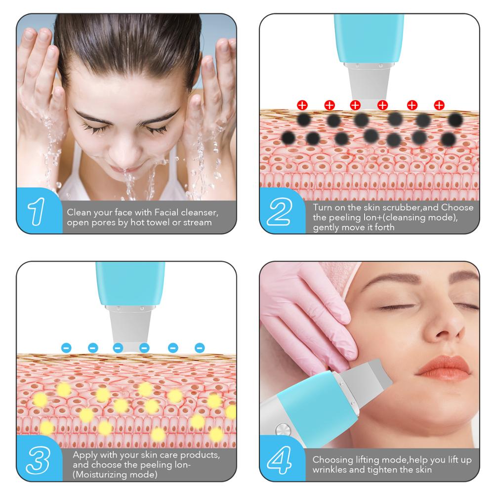 Professionelle Ultraschall Gesicht Haut Wäscher Ultraschall Gesichts Reinigung Spachtel Reiniger Peeling Entferner Schaufel Maschine