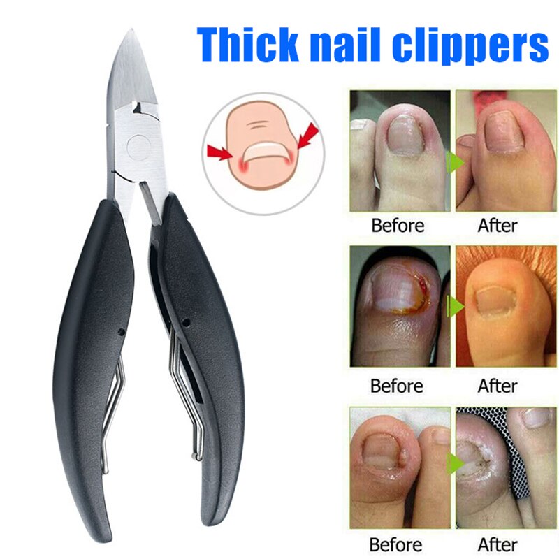 Tåneglklipper til tykke indgroede tå negle kraftig neglesaks skåret tånegle værktøj nail art værktøj  a7: Default Title