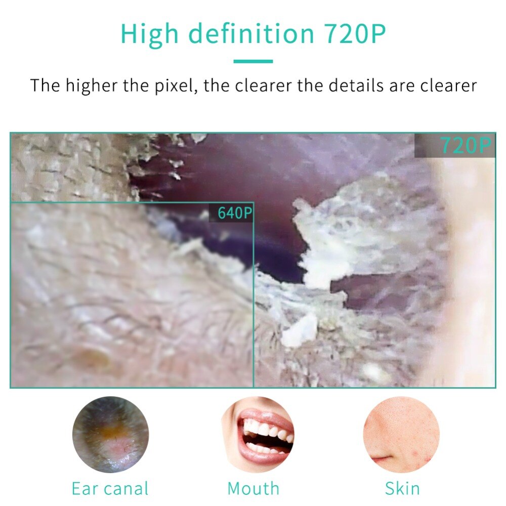 3 in 1 WiFi Endoskop Inspektion Kamera Endoskop Inspektion Ohr Wachs Entferner Werkzeug Wasserdichte Kamera Für Android & IOS Smartphone