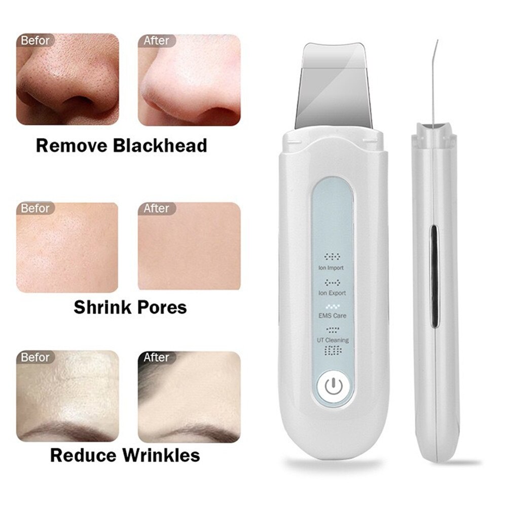 Ultrasonic Skin Scrubber Usb Deep Face Cleaning Shovel Blackheads Peeling Face Cleanser Skin Spatula Tool