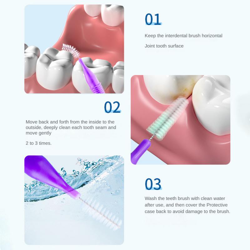 Mondverzorging Push-Pull Interdentale Borstels Orthodontische Draad Tandenborstel Geïmporteerd Kaliber 0.4-1.0Mm Gratis Shippingbox Borstels