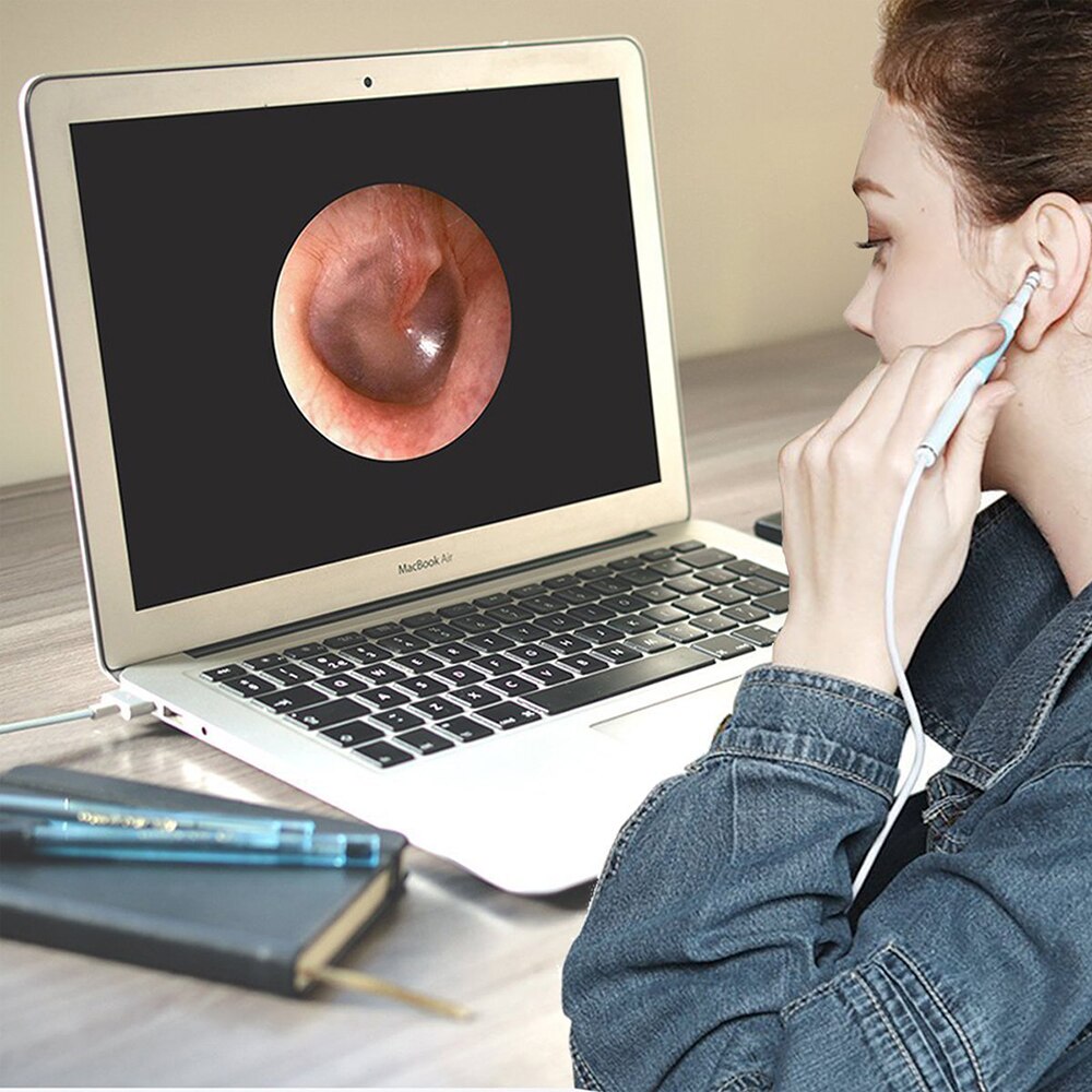 En Ohr, Reinigung, Endoskop, USB, Visuelle, Ohr, Lay, 5,5mm, cámara de 0,3 MP, Android, PC, Ohr, pick Otoskop, Endoskop, werkzeug