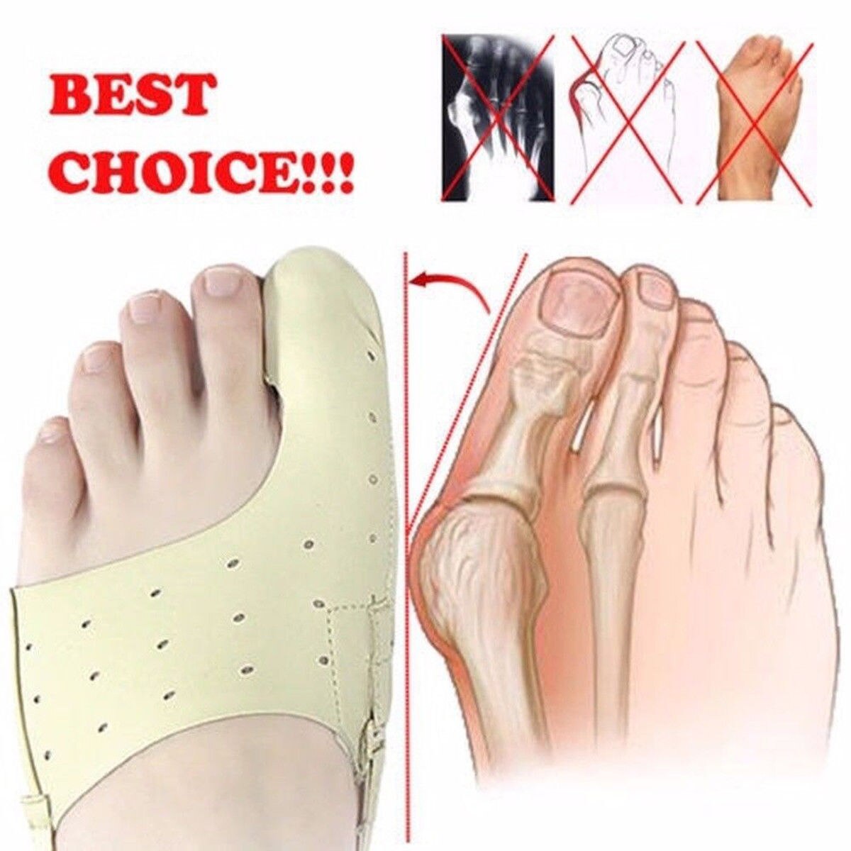 Elastischer Ballen-Korrektor, 1-teiliges Fußpflege-Werkzeug, große Fußknochen, Zehenspreizer, orthopädisches Hallux-Valgus-Zubehör