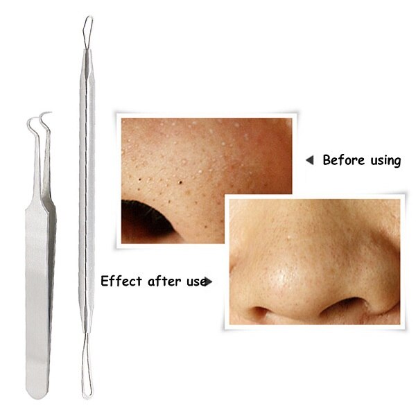 Stainless Steel Pimple Acne Extractor Blackhead Remover Needles Pimple Blemish Acne Treatments Face Skin Care Tools Needles Set: Style 7