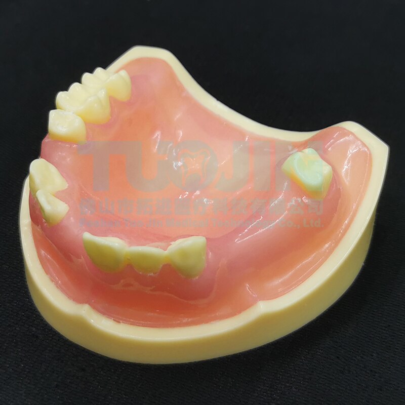Dental Harz Zähne Tipodont Modell Für Dental Techniker Praxis Lehre Gum Zähne Kiefer Modell Zahnmedizin Ausrüstung: TYPE 13