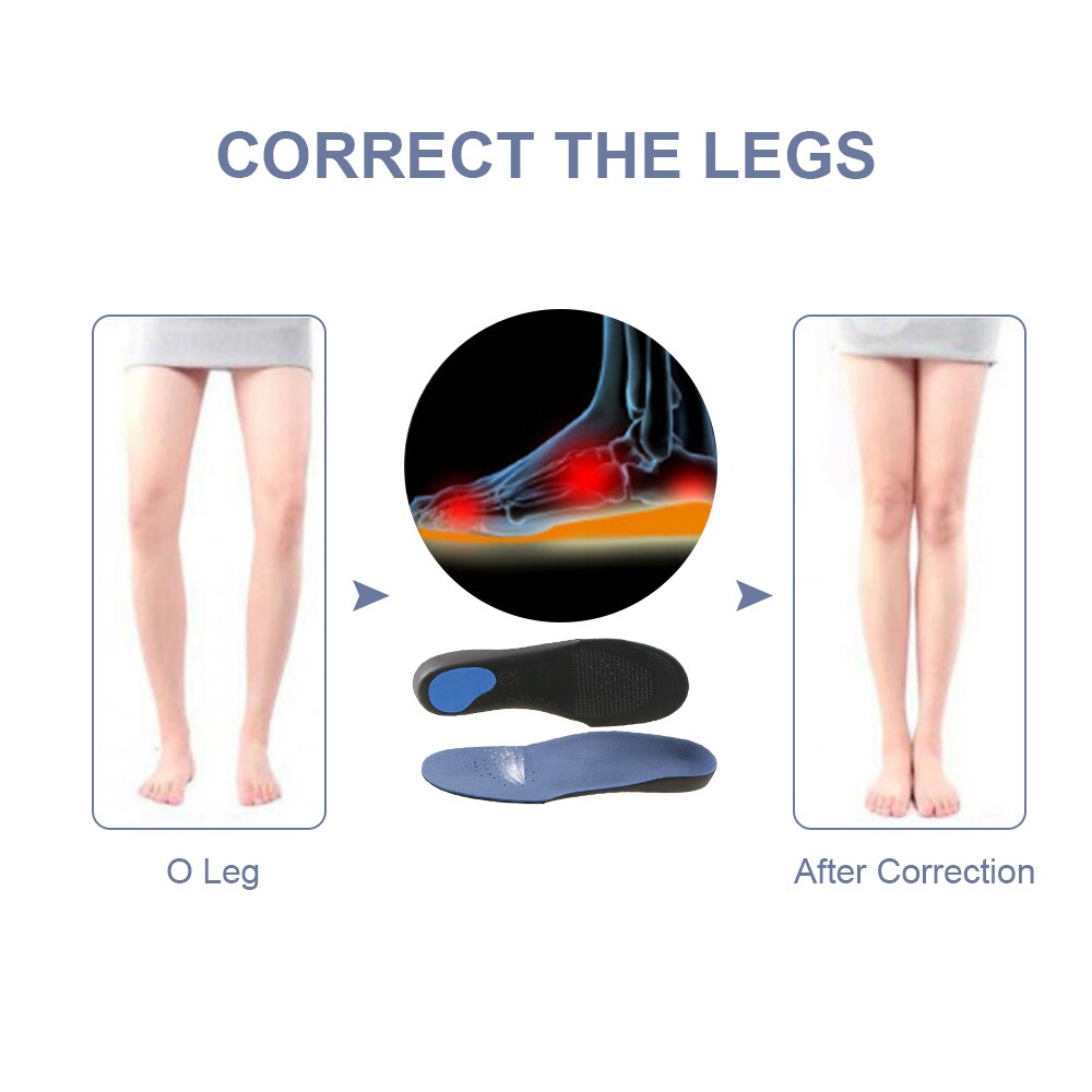 Orthopedic InsolesFlatfoot Orthotics Cubitus Varus Orthopedic Foot Pad Care Insole Unisex Deodorant Insole