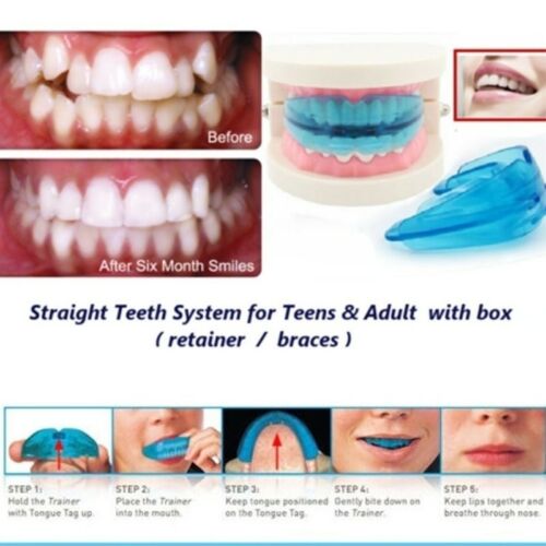 Lige tænder system bid ret tand tænder tandregulering holderen klar: Default Title