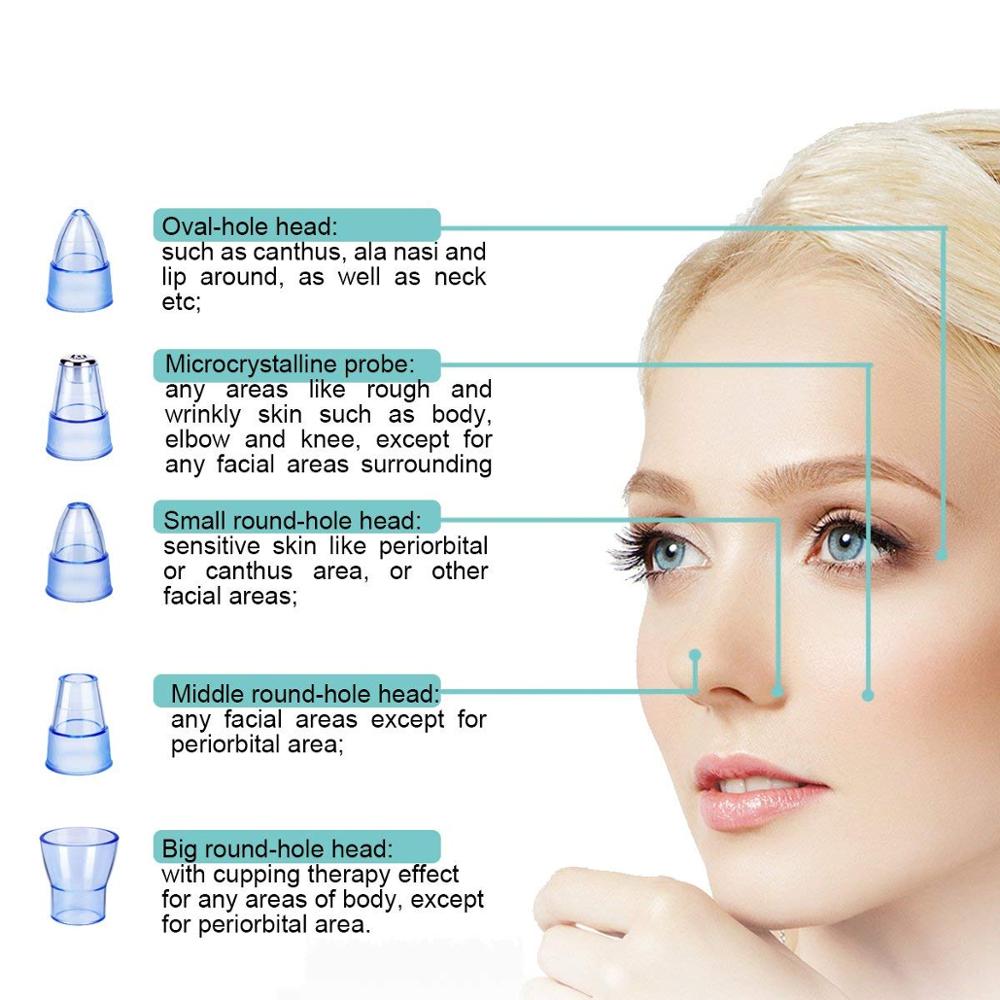 Vacuum Blackhead Remover Extractor USB Rechargeable Facial Acne White head Pimple Pore Nose Face Cleanser Tool Device