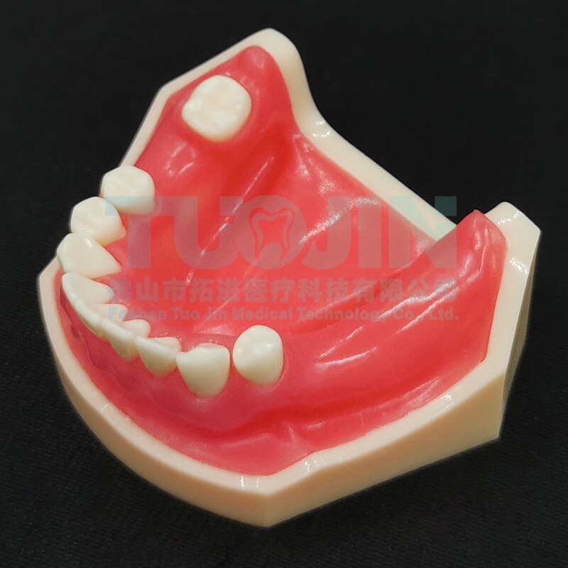 Dental Harz Zähne Tipodont Modell Für Dental Techniker Praxis Lehre Gum Zähne Kiefer Modell Zahnmedizin Ausrüstung: TYPE 11