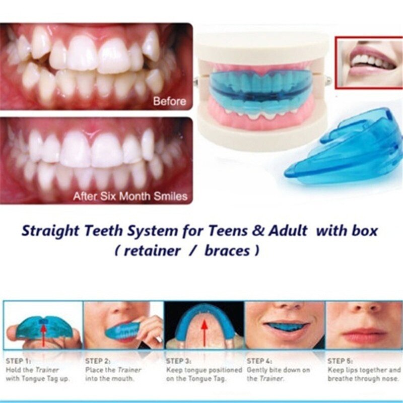 Boksen Tandensteunen Mouth Guard Orthodontische Retainer Vooruitstekende Tand Correctie Ondersteuning Rechte Tand Systeem Voor Doos Muay Thai