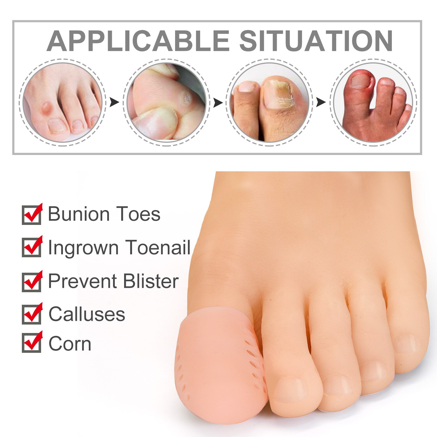 2 st= 1 par stora hallux valgus korrigeringsskydd tumme silikon fotavskiljare liktornar blåsor tåhätta skydd sjukvård pedikyr