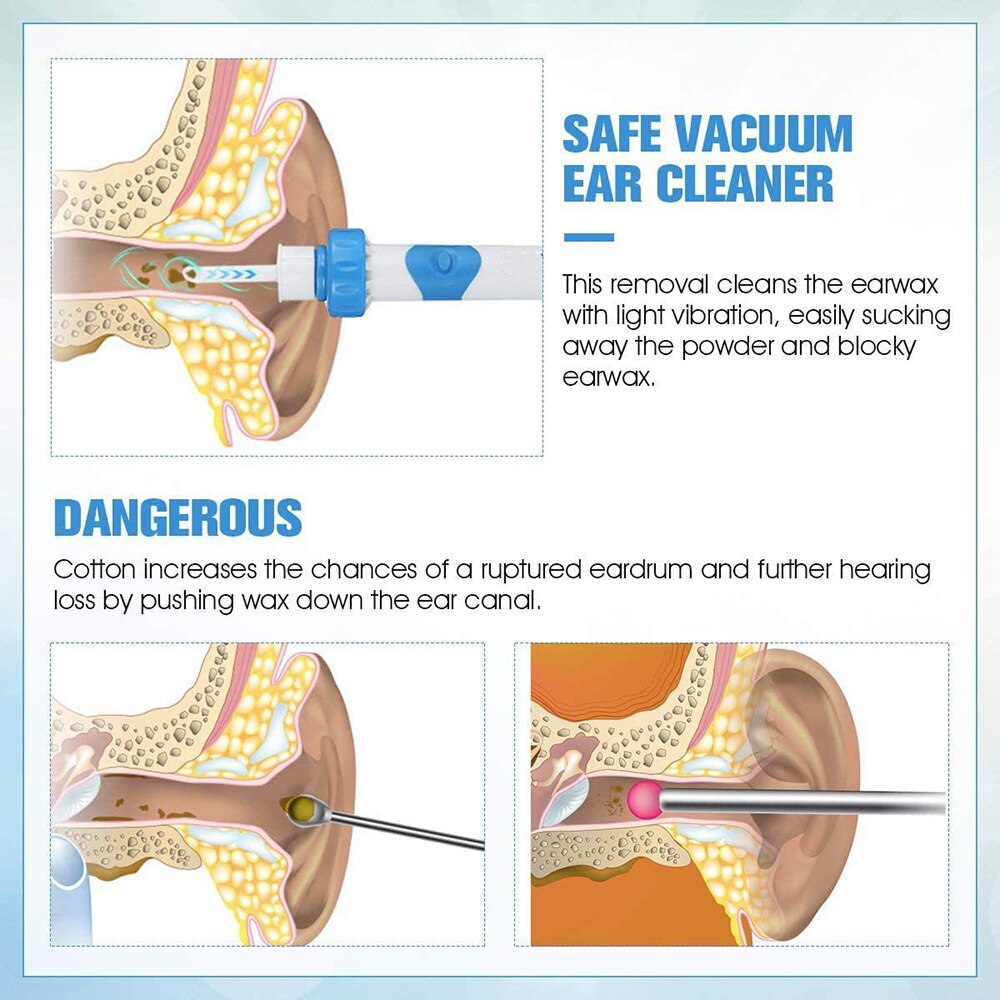 Nettoyeur d&#39;oreille électrique, cure-oreille de sécurité, outils pour enlever la cire d&#39;oreille, ensemble de soins pour enfants, outils de soins pour adultes et bébés