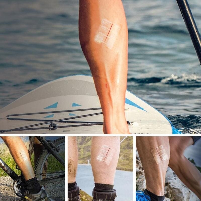 3 Stks/zak Fda Gecertificeerd Rits Pleister Outdoor Geen-Naaien Quick Wond Dressing Hechtdraad Tape Bandage Hechtdraad-gratis Zip Band-Aids Tool