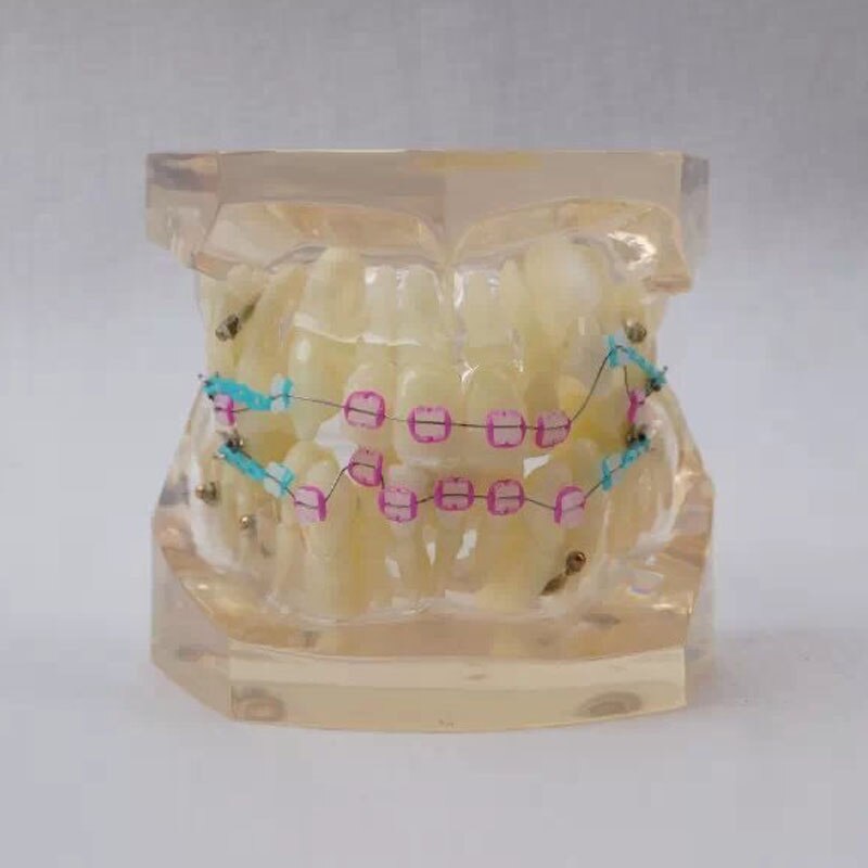 24pcs Tanden alle keramische beugel Orthodontie Tandheelkundige Model