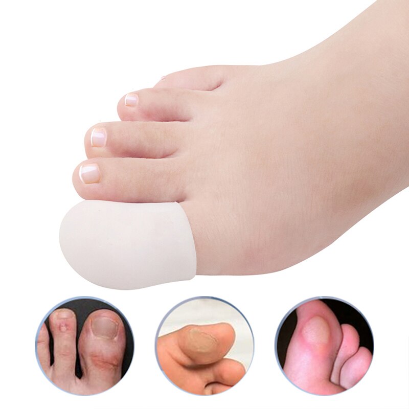 Pexmen 2 Teile/para Gel Zehe Separator Ballen Knochen Ektropium Erzähler Zehen Außen Gerät Fuß Pflege Werkzeuge Hallux Valgus Korrektor: Grün
