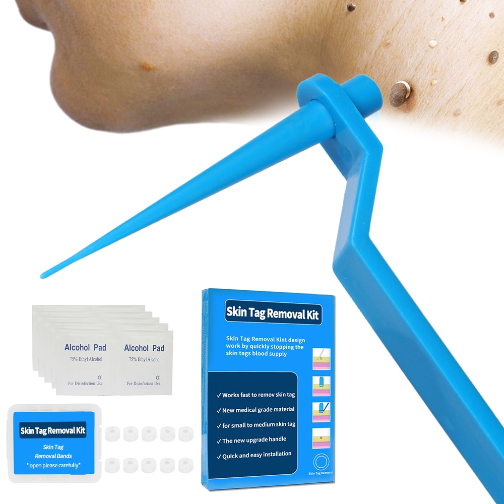 Medische Huid Tag Doden Huid Mol Wratten Remover Micro Band Huid Tag Verwijderen Kit Met Reiniging Wattenstaafjes Volwassen Mol Wratten gezichtsverzorging