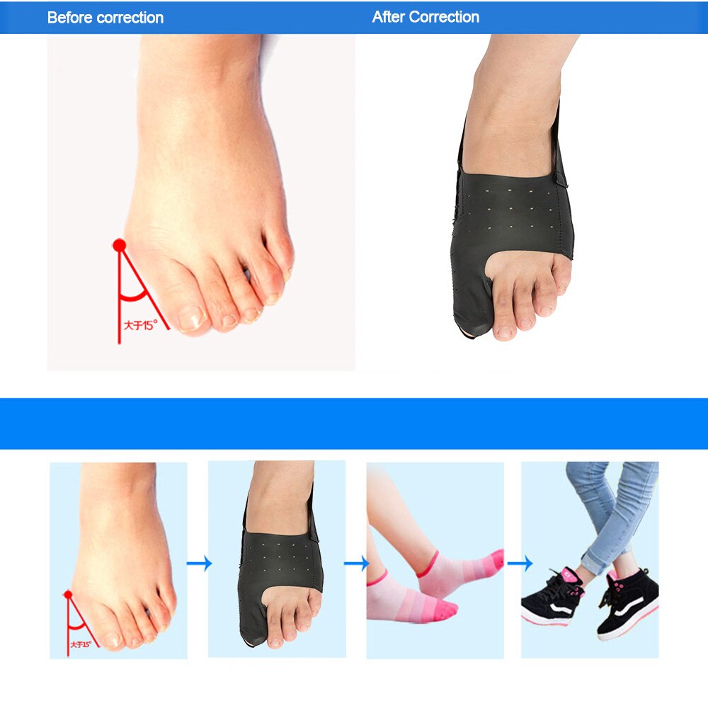 Ultra-thin Big Toe Bunion Corrector Hallux Valgus Straightener Foot Pain Relief Orthotics Foot Care Tool Unisex PU Elastic Fiber