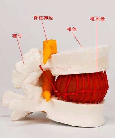 Menschlichen lumbalen bandscheibe Demonstration modell skelett modell Menschlichen lenden wirbelsäule wirbelsäule gemeinsam modell medizinische