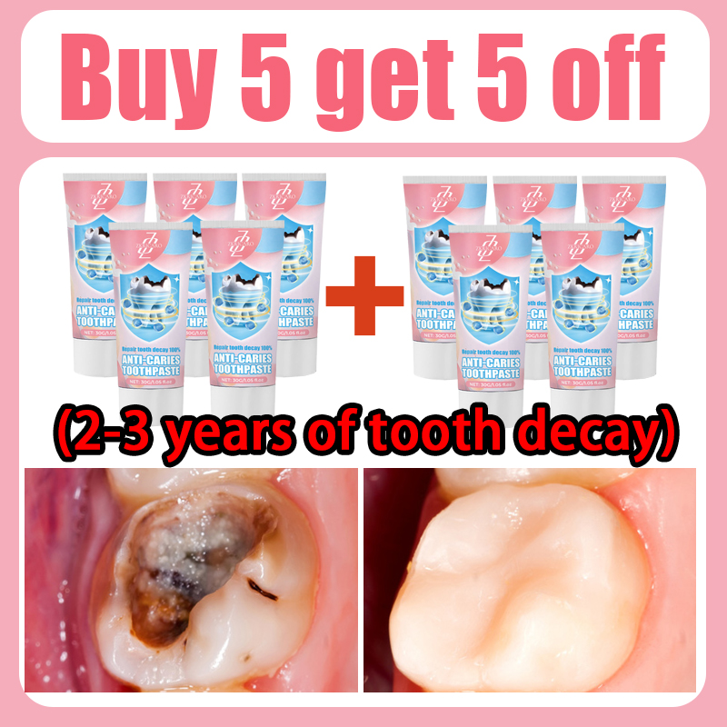 Latest Teeth Cleaning to Eliminate Tooth Decay