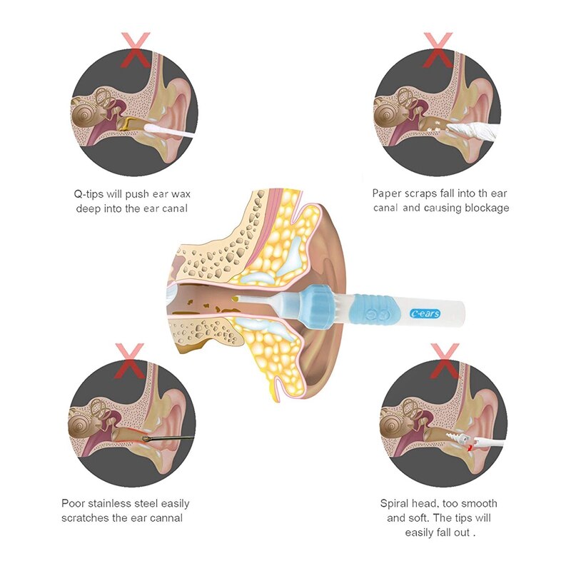 Ear Wax Removal Kit, Ear Cleaner, Electric Ear Wax Removal Tool Soft Silicone Automatic Ear Wax Removal Kit with LED Light Power