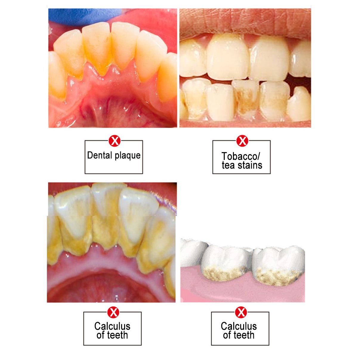 4 Grades Adjustable Electric Ultrasonic Sonic Remove Dental Stones Cleaning Instrument Washing Machine Whitening Teeth Oral Care