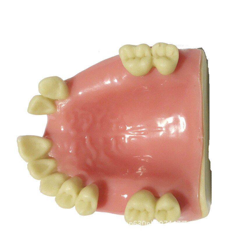 Práctica de sutura gingival suave de 7 tipos, formación Dental, implante de simulación de práctica de implante, modelo de dientes faltantes osteoaxilares: Azul